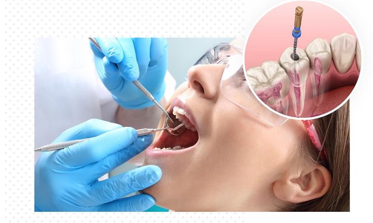 جراحی ریشه دندان و کشیدن آن چگونه انجام می‌شود؟